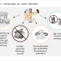 Beratungsmaterialien Pankreatitis fetev-pankreatitis-therapiesaeulen-akute-pankreatitis.png